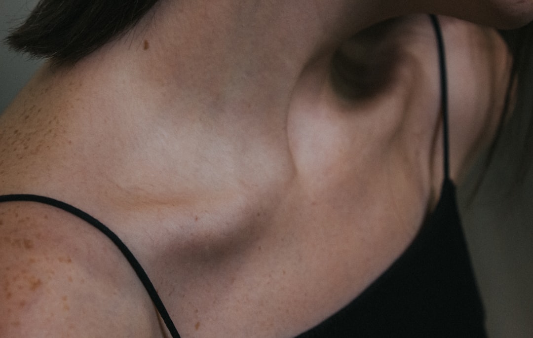 morpheus8 on neck and chest