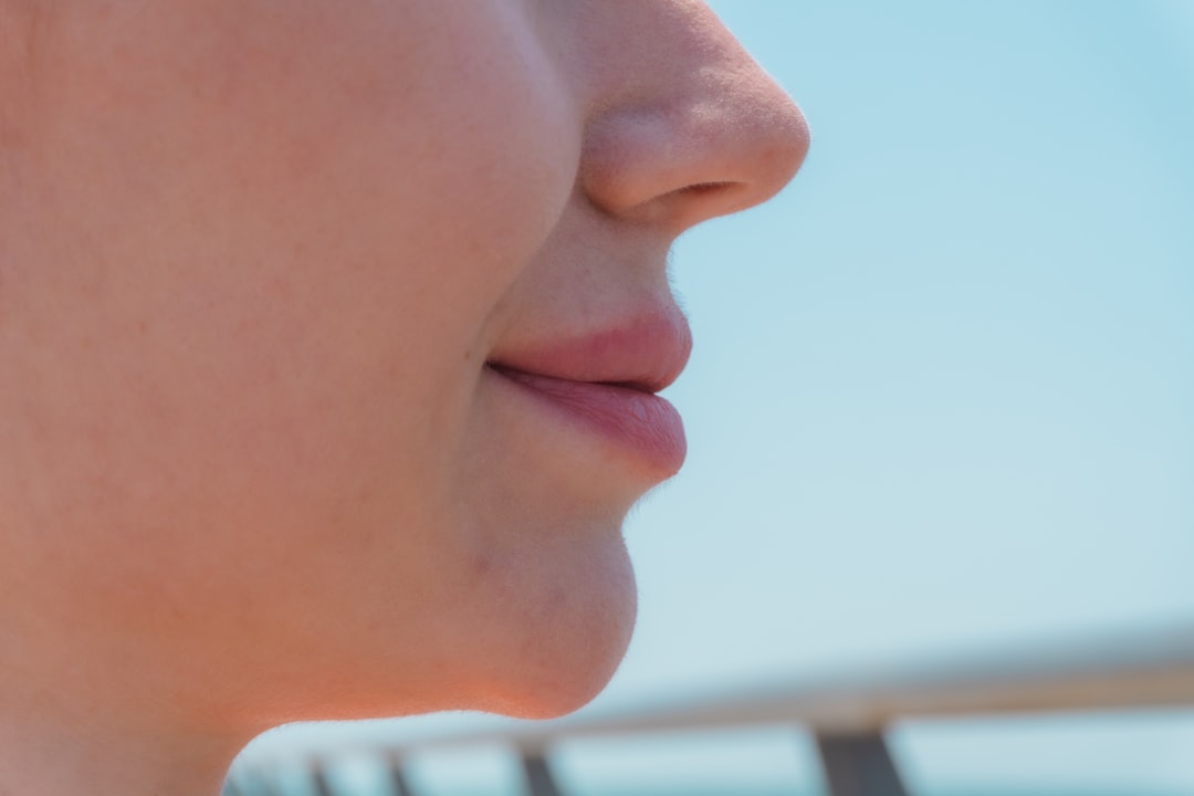 lip filler
